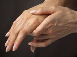 Octubre, Mes de la Artritis Reumatoidea