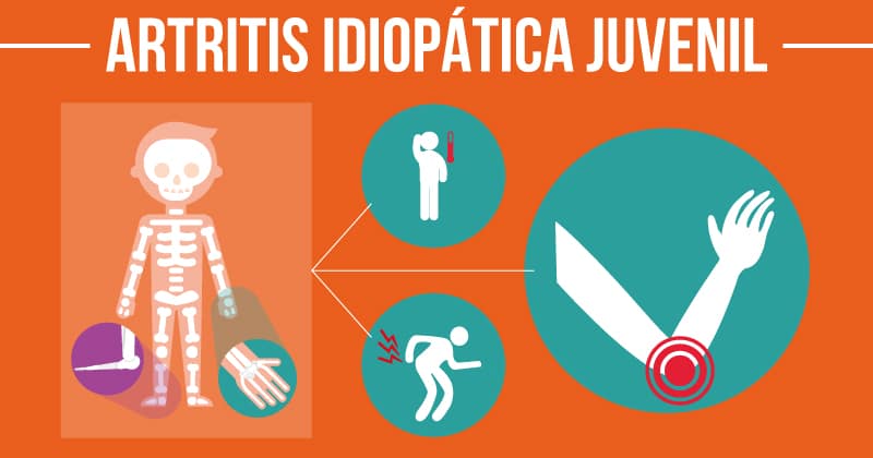 Artritis Idiopática Juvenil (un resumen)