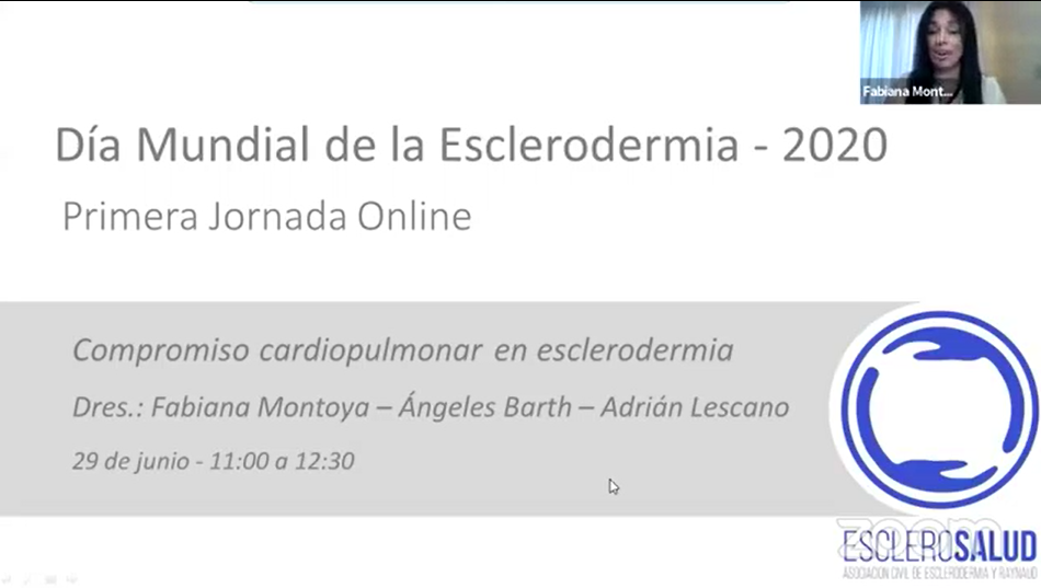 Compromiso cardiopulmonar en esclerodermia – Fabiana Montoya