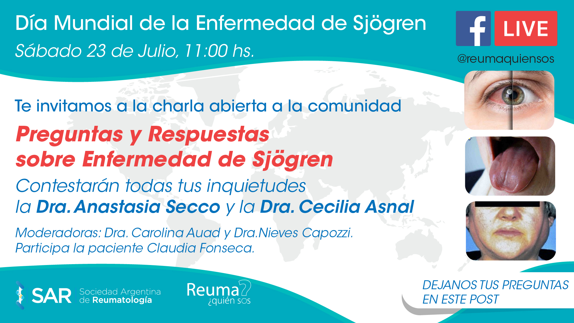 Día Mundial de la Enfermedad de Sjögren – Video Charla a la comunidad